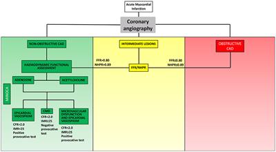 The Pivotal Role of Invasive Functional Assessment in Patients With Myocardial Infarction With Non-Obstructive Coronary Arteries (MINOCA)